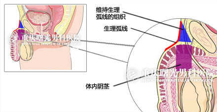 Ϊ�ǲ���״̬�µ�����ʸ״�����ͼ